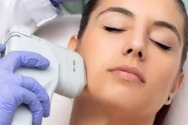 Image of woman having HIFU Dover treatment
