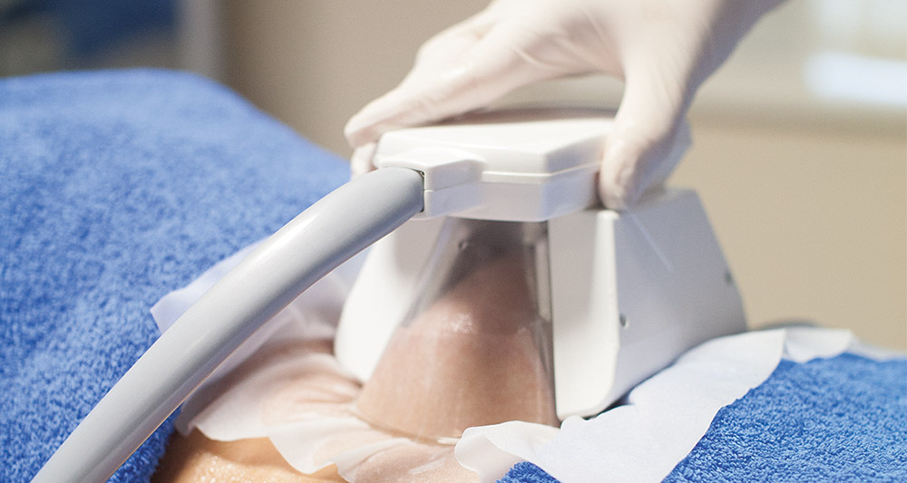 How Fat Freezing and HIFU Work Together? 2 Multiple Areas in One Session HIFU and Fat Freezing Dover