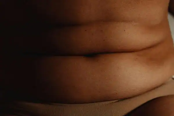 The Hidden Connection: How Stress Shapes Your Fitness and Body Composition 3 image of what stress can do on the stomach area and how Lipo 360 Dover can help to change your body shape.